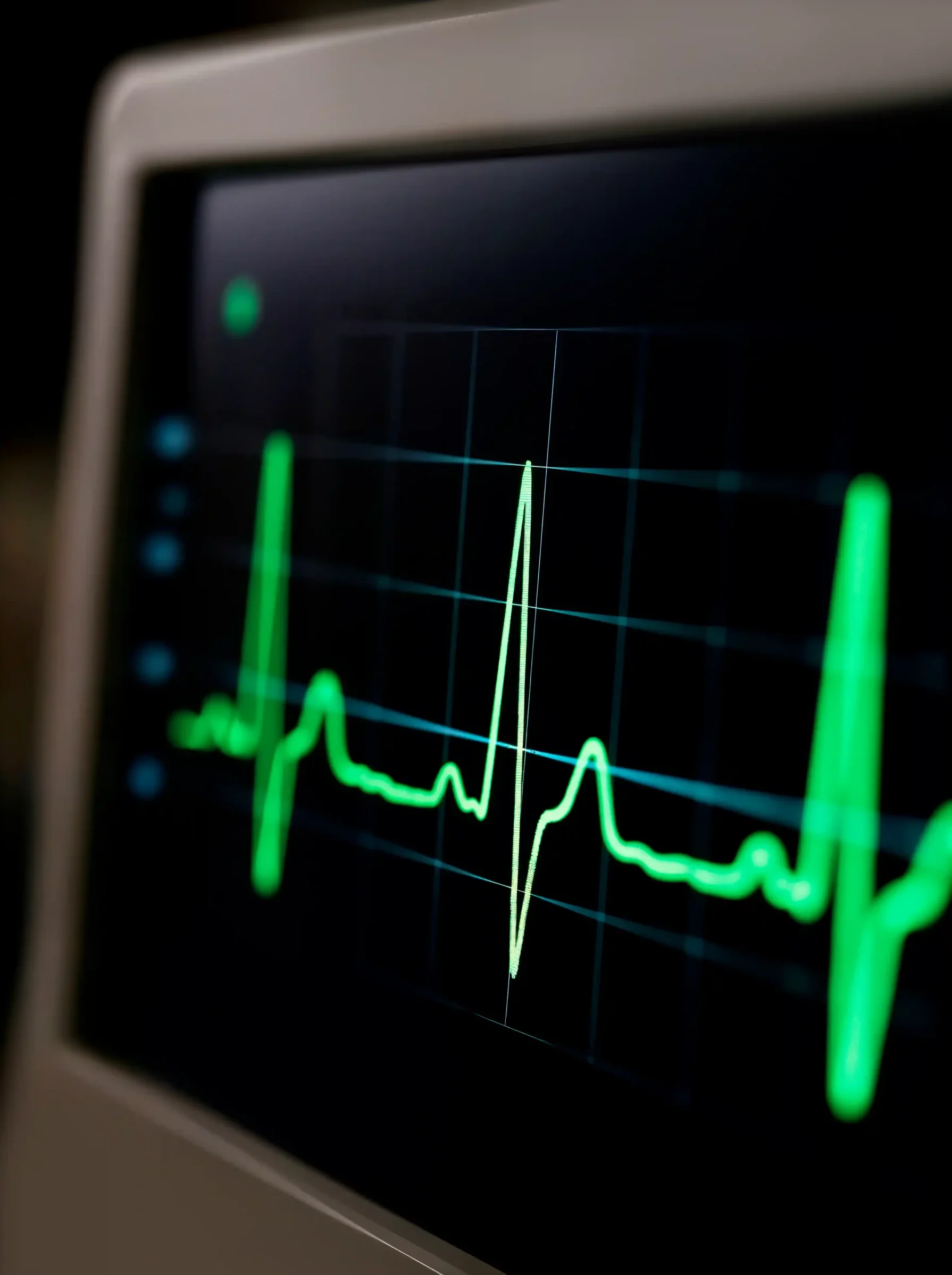 ecg-monitor-displaying-heartbeat